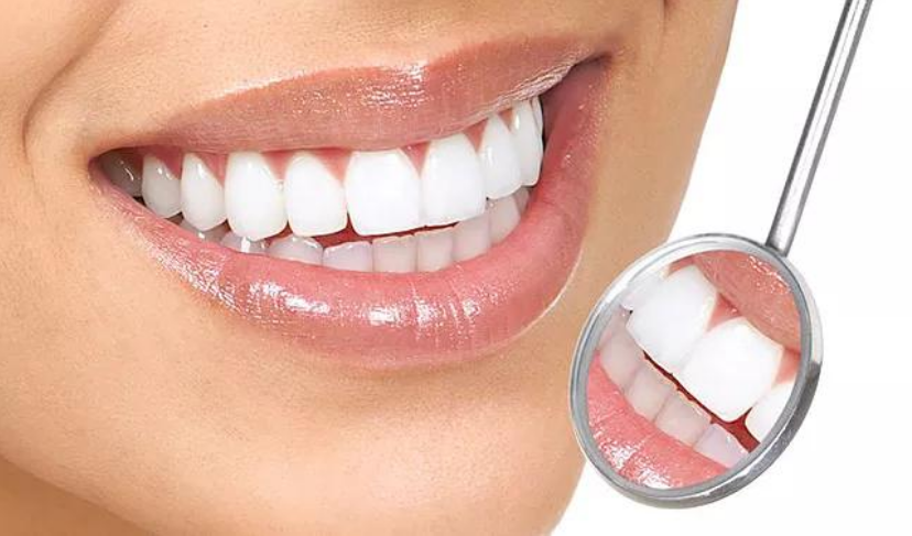 قشور الأسنان